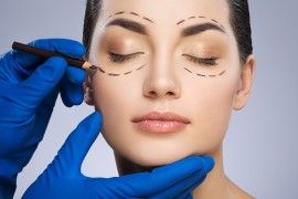 Blepharoplasty